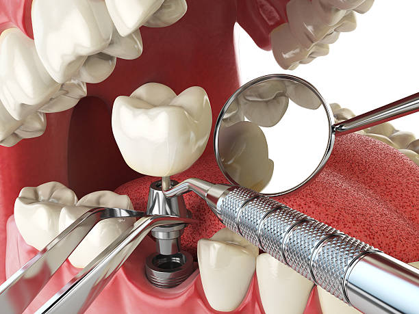 Reliable IA Emergency Dentist Solutions